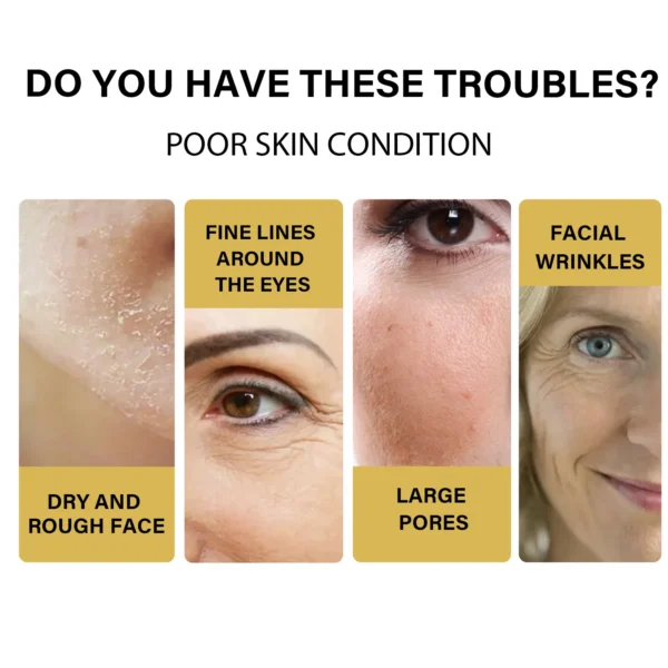 EELHOE Protein Lifting Thread Kit Face Lift Plump Silk Protein Line Carving Anti Aging Firming Fade Fine Wrinkle Serum Skin Care - Image 4